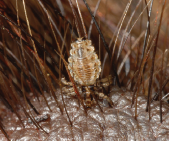 Hog Lice