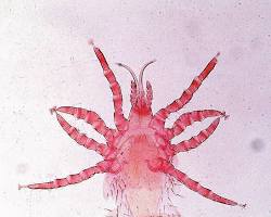 Bird Mites - Pestipedia