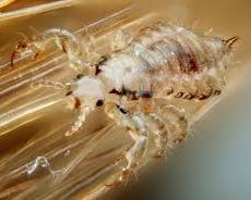 Head Lice - Pestipedia